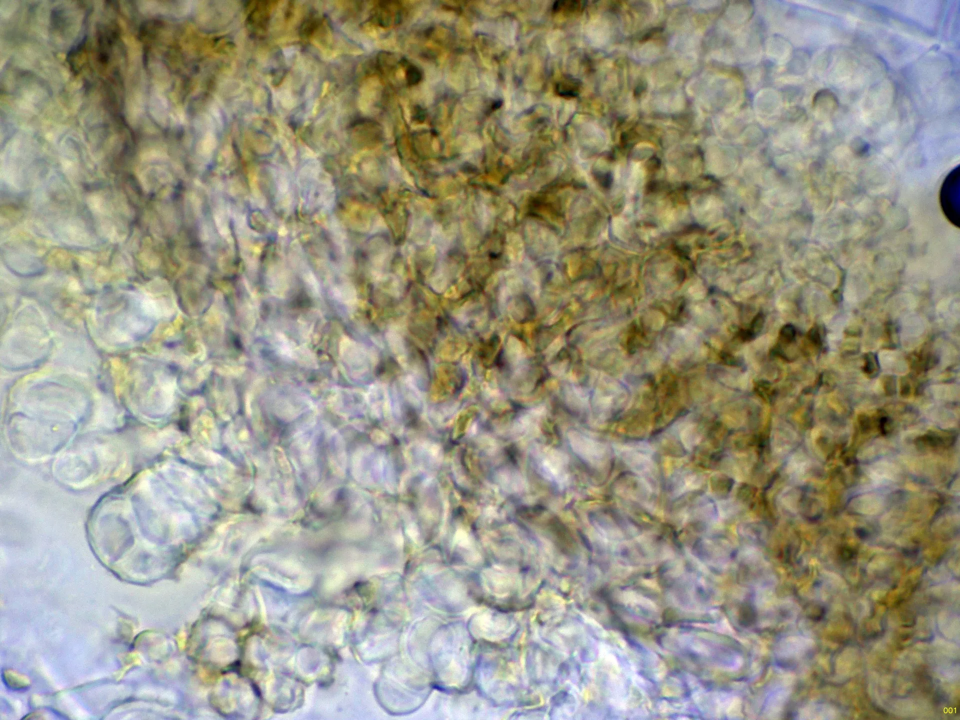 Microscopía de Tubeufia cerea - 10 - Hifas peridio Melzer-001